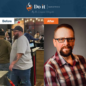 Slider image (4) Do It Bariatrics